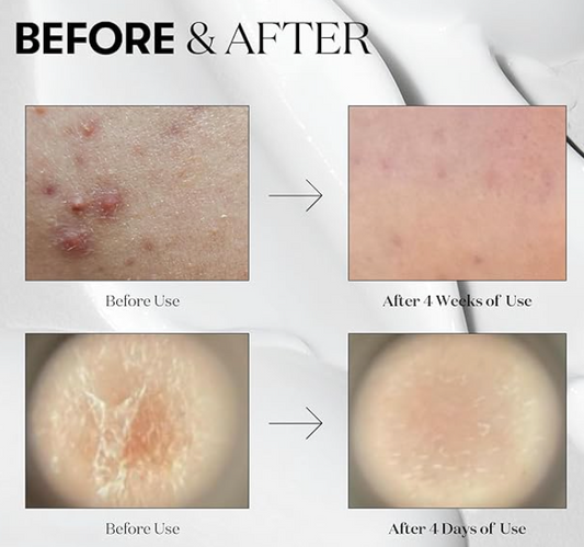 VT COSMETICS - VT Reedle shot 100